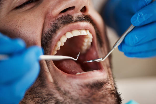 Fast & Reliable Emergency Dental Services in NM